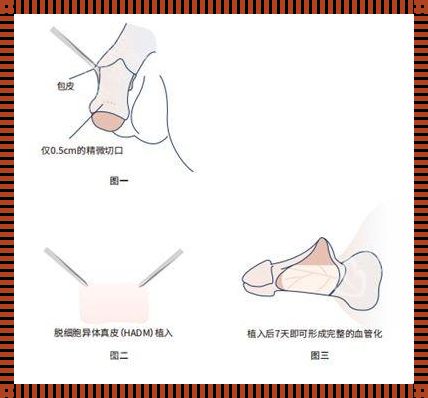 男子延长之道的探索与思考