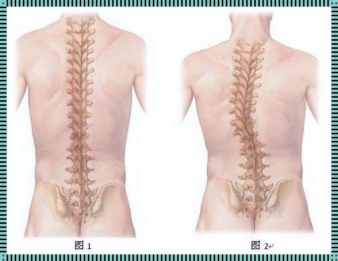 吉首装修斩获脊柱弯曲的正确说法：护脊生活从点滴开始