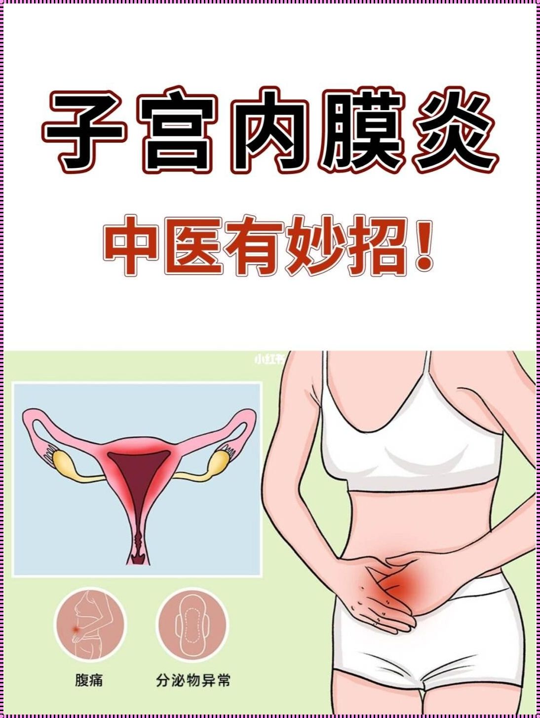 慢性子宫内膜炎治疗时程探究