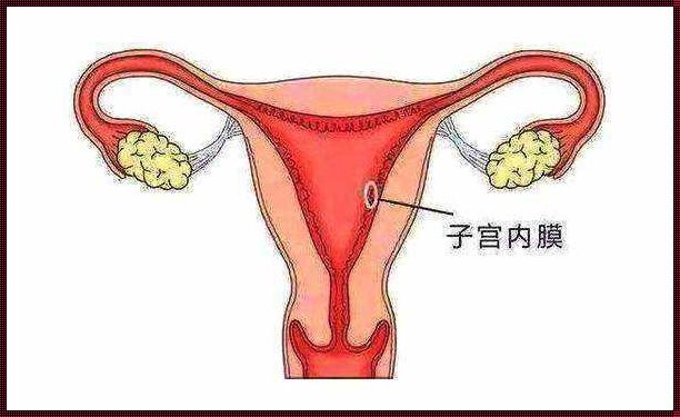 《装修惊现四川省，CSF宫腔灌注需要多长时间？》