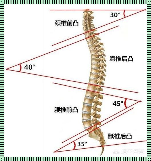 腰杆挺直，生活更美丽——如何判断腰椎前凸