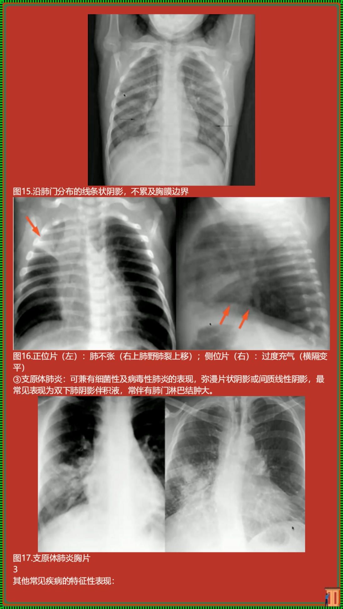 一次特别的体验：我想要看胸片曝光照