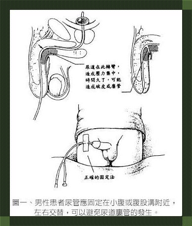 「尿道堵塞」攻略：七宗罪式的讽刺艺术