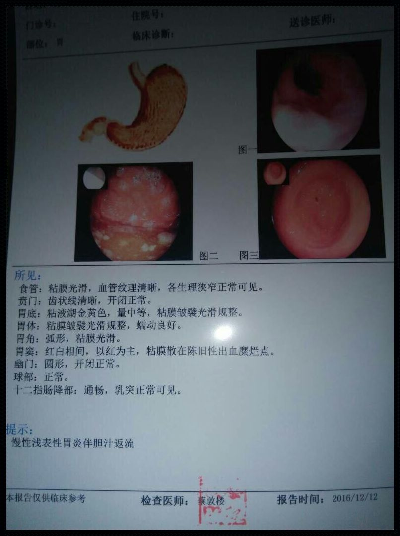 慢性浅表性胃炎伴糜烂多久能好（出血胃糜烂性胃炎需要吃药多久?）