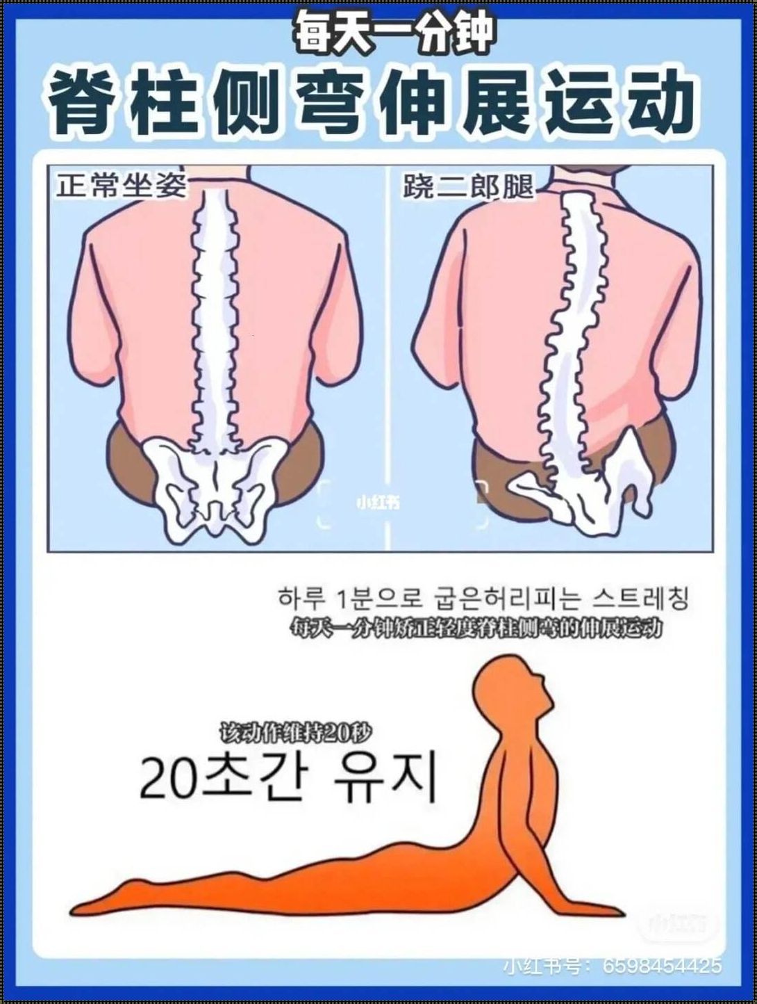 少年脊柱侧弯自我矫正法的探索与实践